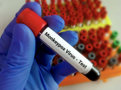 Bermutasi Lebih Cepat, 50 Strain Baru Monkeypox Ditemukan